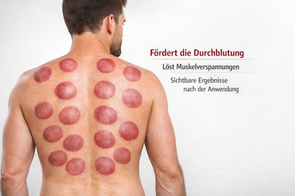 Elektrisches Schröpfgerät 3‑in‑1 – Wärme + Vakuum + Massage  Anti‑Cellulite & Muskelentspannung